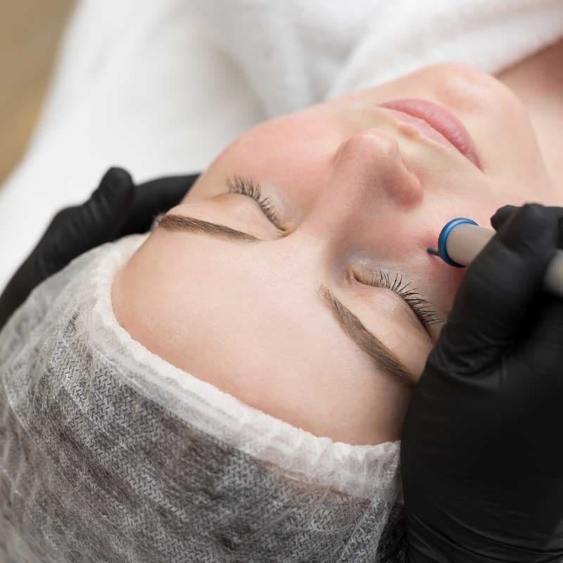 Aesthetic skin treatment